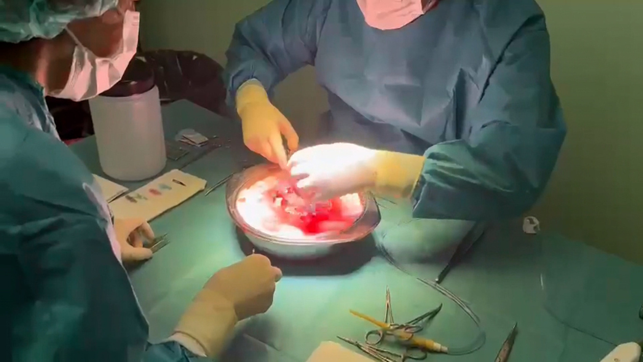 Castilla y León registra 434 órganos donados en 2025