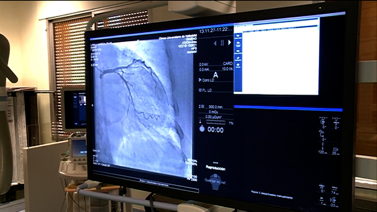 Castilla y León lidera la atención cardiovascular en España