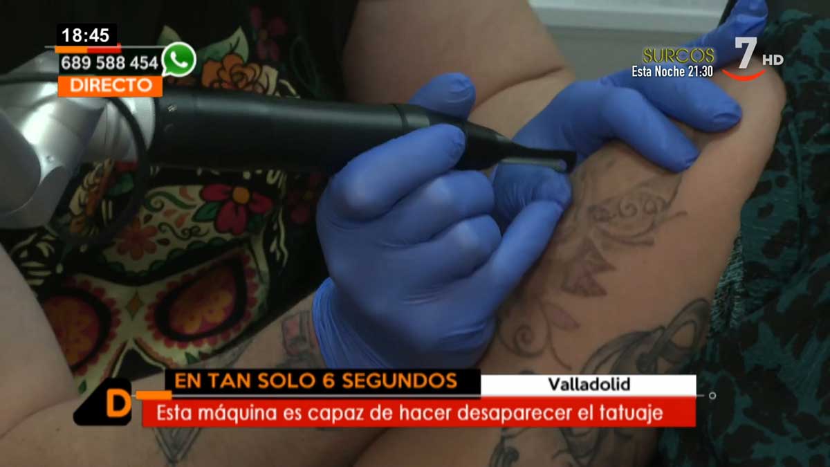 La eliminación de tatuajes en seis segundos - cyltv.es